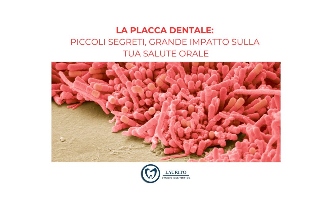 La Placca Dentale: Piccoli Segreti, Grande Impatto sulla Tua Salute Orale