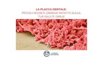 La Placca Dentale: Piccoli Segreti, Grande Impatto sulla Tua Salute Orale